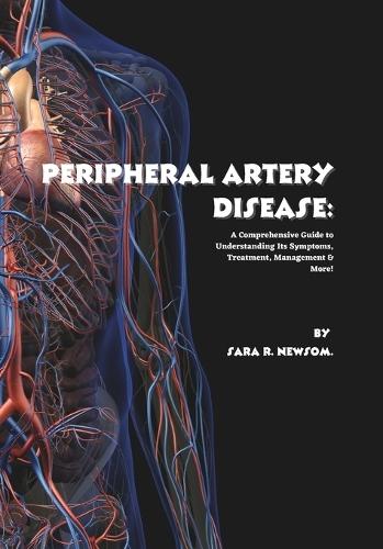 Peripheral Artery Disease: A Comprehensive Guide to Understanding Its Symptoms, Treatment, Management & More!