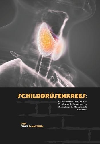 Schilddrüsenkrebs: Ein umfassender Leitfaden zum Verständnis der Symptome, der Behandlung, des Managements und mehr!