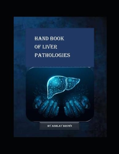 Handbook Of Liver Pathologies