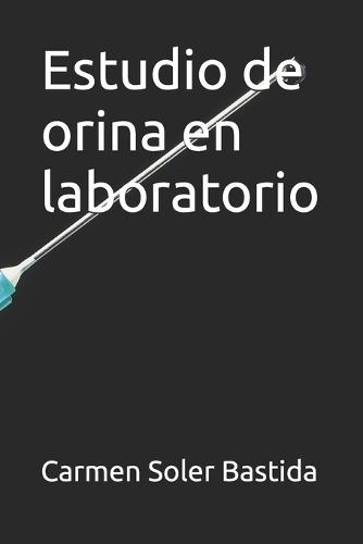Estudio de orina en laboratorio
