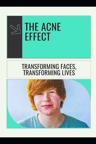 The Acne Effect: Transforming Faces, Transforming Lives