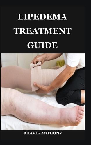 Lipedema Treatment Guide: Advanced Treatment Protocols, Compression Strategies, Functional Fitness, and Lifestyle Adjustments for Sustainable Wellness