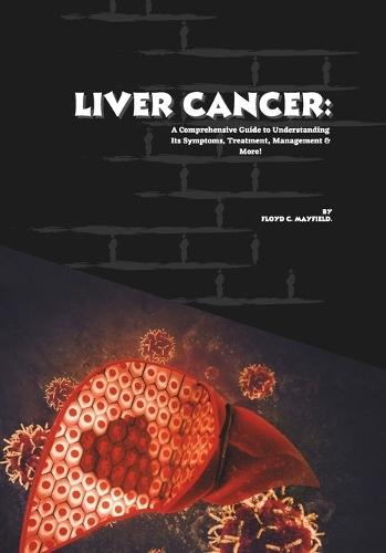 Liver Cancer: A Comprehensive Guide to Understanding Its Symptoms, Treatment, Management & More!
