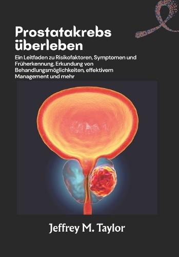 Prostatakrebs überleben: Ein Leitfaden zu Risikofaktoren, Symptomen und Früherkennung, Erkundung von Behandlungsmöglichkeiten, effektivem Management und mehr