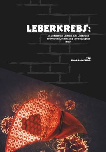 Leberkrebs: Ein umfassender Leitfaden zum Verständnis der Symptome, Behandlung, Bewältigung und mehr!