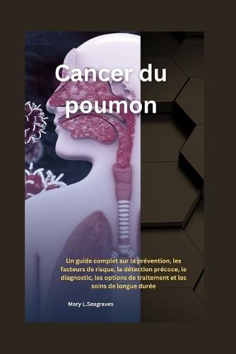 Cancer du poumon: Un guide complet sur la prévention, les facteurs de risque, la détection précoce, le diagnostic, les options de traitement et les soins de longue durée