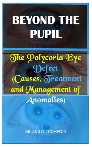 Beyond the Pupil: The Polycoria Eye Defect (Causes, Treatment and Management of Anomalies)