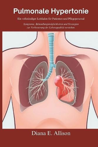 Pulmonale Hypertonie: Ein vollständiger Leitfaden für Patienten und Pflegepersonal: Symptome, Behandlungsmöglichkeiten und Strategien zur Verbesserung der Lebensqualität verstehen.