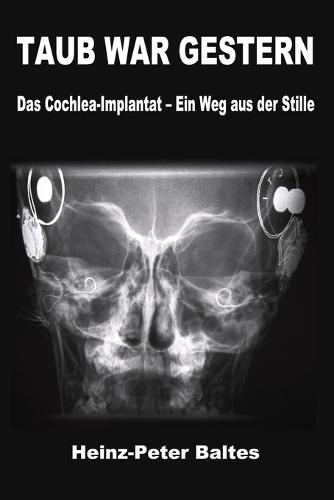 Taub War Gestern: Das Cochlea-Implantat - Ein Weg aus der Stille