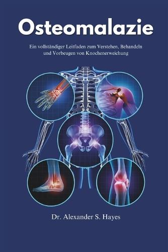 Osteomalazie: Ein vollständiger Leitfaden zum Verstehen, Behandeln und Vorbeugen von Knochenerweichung