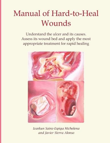 Manual of Hard-to-Heal Wounds: Understand the ulcer and its causes. Assess its wound bed and implement the most appropriate treatment for rapid healing