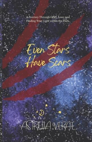 Even Stars Have Scars: A Journey Through Grief, Love, and Finding True Light Within the Dark