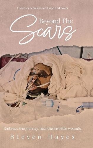 Beyond The Scars: A Journey of Resilience, Hope, and Power