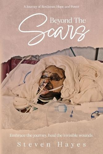 Beyond The Scars: A Journey of Resilience, Hope, and Power