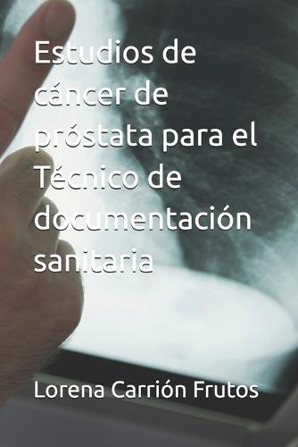 Estudios de cáncer de próstata para el Técnico de documentación sanitaria