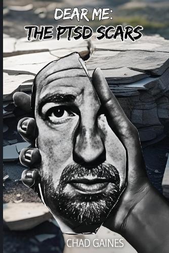 Dear Me: The PTSD Scars