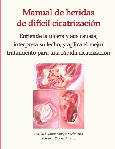 Manual de heridas de difícil cicatrización: Entiende la úlcera y sus causas, interpreta su lecho, y aplica el mejor tratamiento para una rápida cicatrización