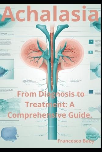 Achalasia: From Diagnosis to Treatment: A Comprehensive Guide.