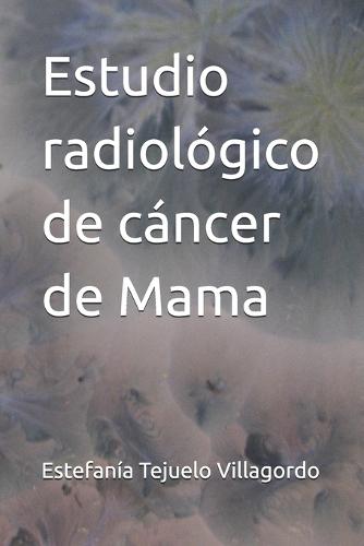 Estudio radiológico de cáncer de Mama