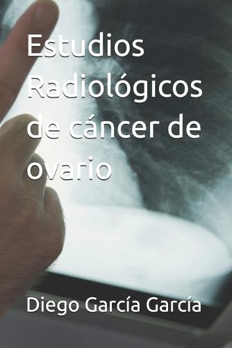 Estudios Radiológicos de cáncer de ovario