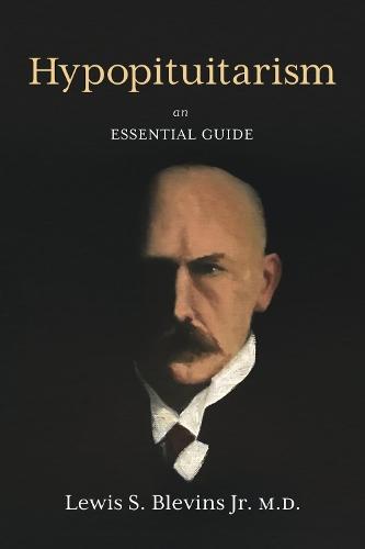 Hypopituitarism: An Essential Guide