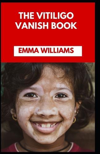 The Vitiligo Vanish Book: Therapy, Management and Prevention