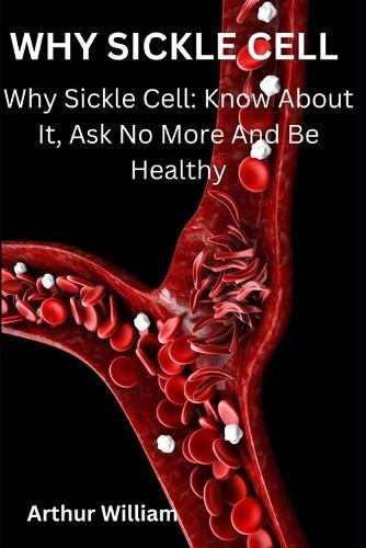 Why Sickle Cell: Why Sickle Cell: Know About It, Ask No More And Be Healthy
