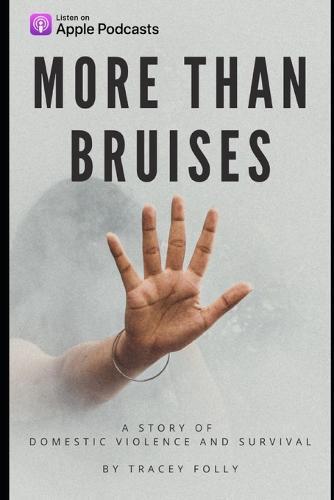 More Than Bruises: A Story of Domestic Violence and Survival