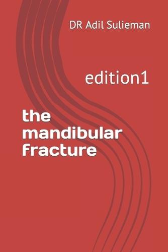 The mandibular fracture: edition1