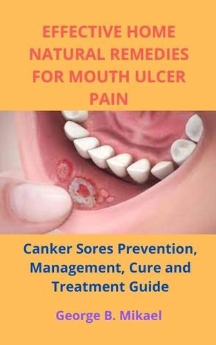Effective Home Natural Remedies for Mouth Ulcer Pain: Canker Sores Prevention, Management, Cure and Treatment Guide