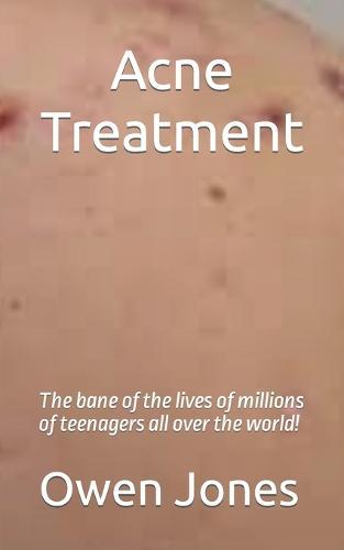 Acne Treatment