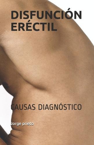 Disfuncion Erectil: Causas Diagnostico