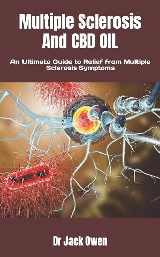 Multiple Sclerosis And CBD OIL: An Ultimate Guide to Relief from Multiple Sclerosis Symptoms