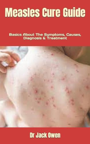 Measles Cure Guide: Basics About The Symptoms, Causes, Diagnosis & Treatment