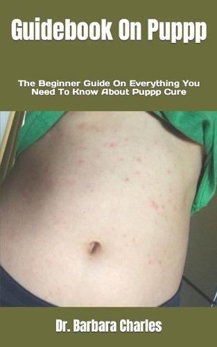 Guidebook On Puppp: The Beginner Guide On Everything You Need To Know About Puppp Cure