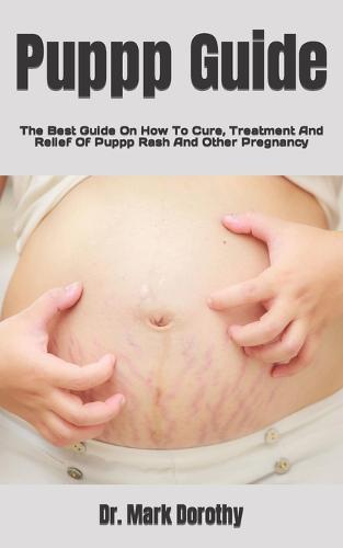 Puppp Guide: The Best Guide On How To Cure, Treatment And Relief Of Puppp Rash And Other Pregnancy
