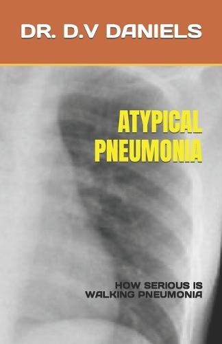 Atypical Pneumonia: How Serious Is Walking Pneumonia