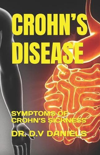 Crohn's Disease: Symptoms of Crohn's Sickness
