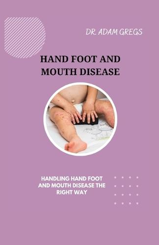 Hand Foot and Mouth Disease: Handling Hand Foot and Mouth Disease the Right Way
