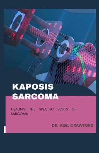 Kaposis Sarcoma: Healing the Specific Sorts of Sarcoma