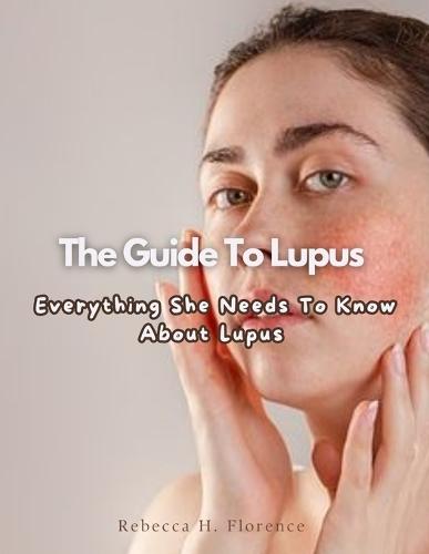 The Guide To Lupus: Everything She Needs To Know About Lupus