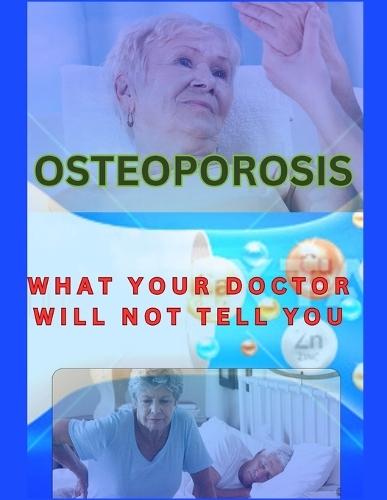 Osteoporosis: What Your Doctor Will Not Tell You