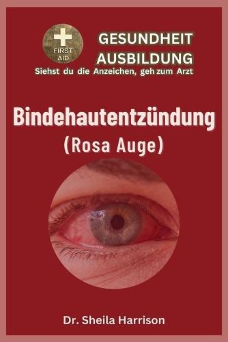 Bindehautentzündung (rosa Auge): Symptome, Ursachen, Diagnose, Behandlung, Medikamente, Prävention und Kontrolle, Management