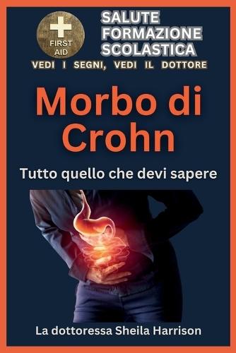 Morbo di Crohn: tutto quello che devi sapere: Sintomi, cause, diagnosi, trattamento, farmaci, prevenzione, controllo e gestione