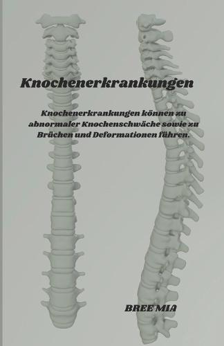 Knochenerkrankungen: Knochenerkrankungen können zu abnormaler Knochenschwäche sowie zu Brüchen und Deformationen führen.