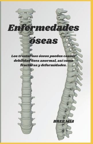 Enfermedades óseas: Los trastornos óseos pueden causar debilidad ósea anormal, así como fracturas y deformidades.