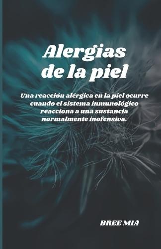Alergias de la piel: Una reacci�n al�rgica en la piel ocurre cuando el sistema inmunol�gico reacciona a una sustancia normalmente inofensiva.