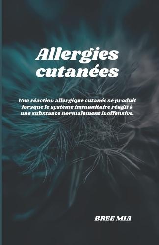 Allergies cutan�es: Une r�action allergique cutan�e se produit lorsque le syst�me immunitaire r�agit � une substance normalement inoffensive.
