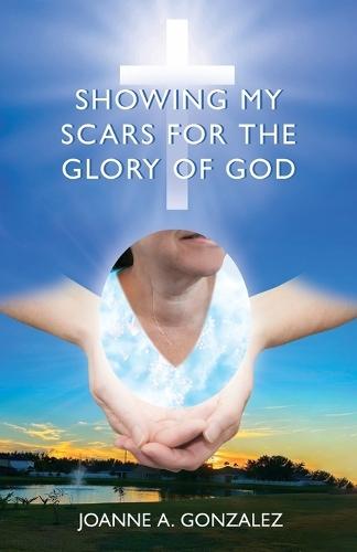 Showing My Scars for the Glory of God
