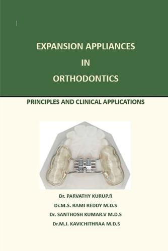 Expansion Appliance in Orthodontics